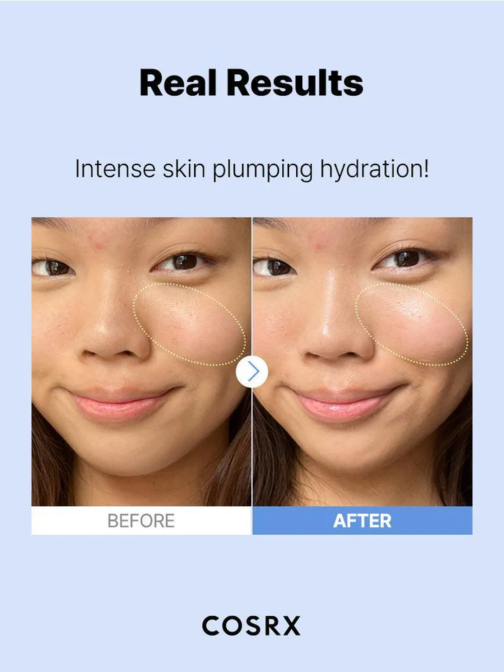 The Hyaluronic Acid 3 Serum — view 5